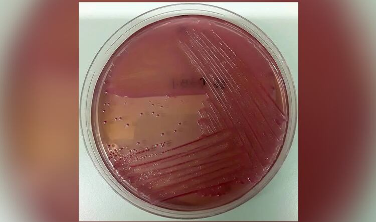 Researchers uncover potential underappreciated threat to food safety