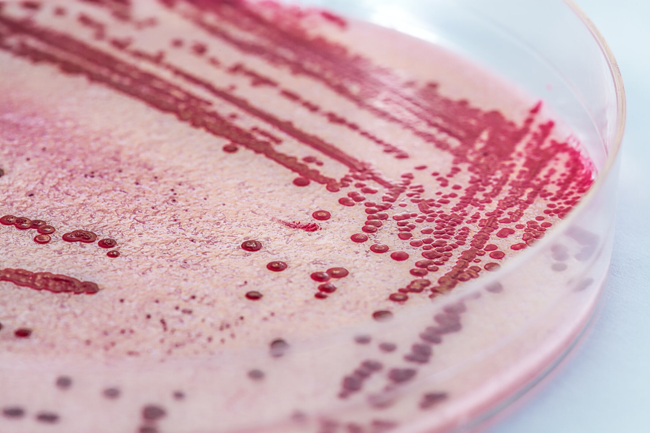 New report guides on Listeria monocytogenes within food manufacturing
