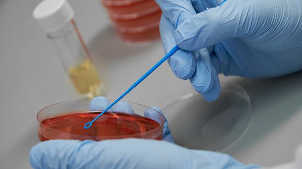 new-panel-pic_Jv19826-61a-sample-dish-agar-plate-swab.jpg