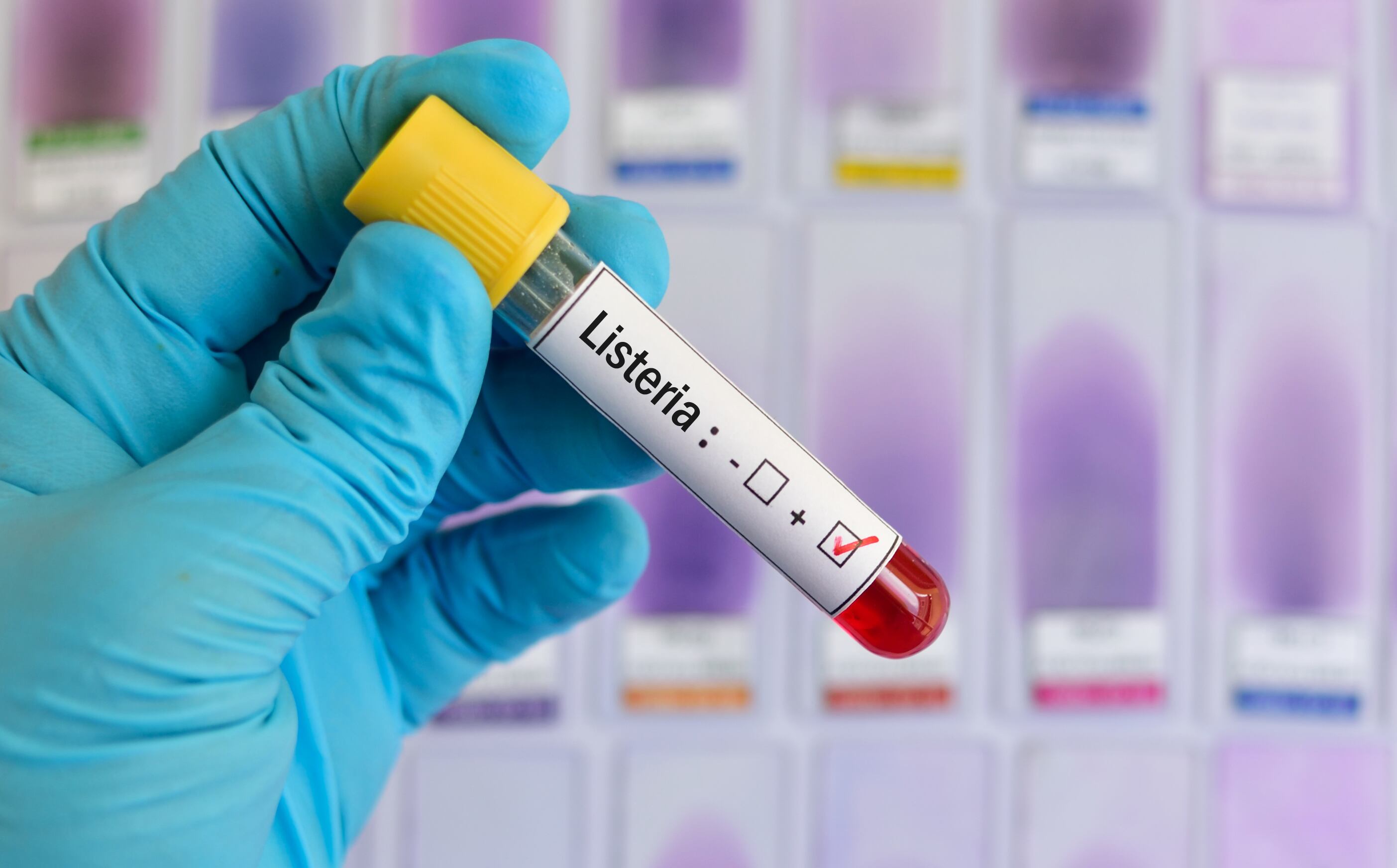 179 Listeriosis cases in England and Wales last year