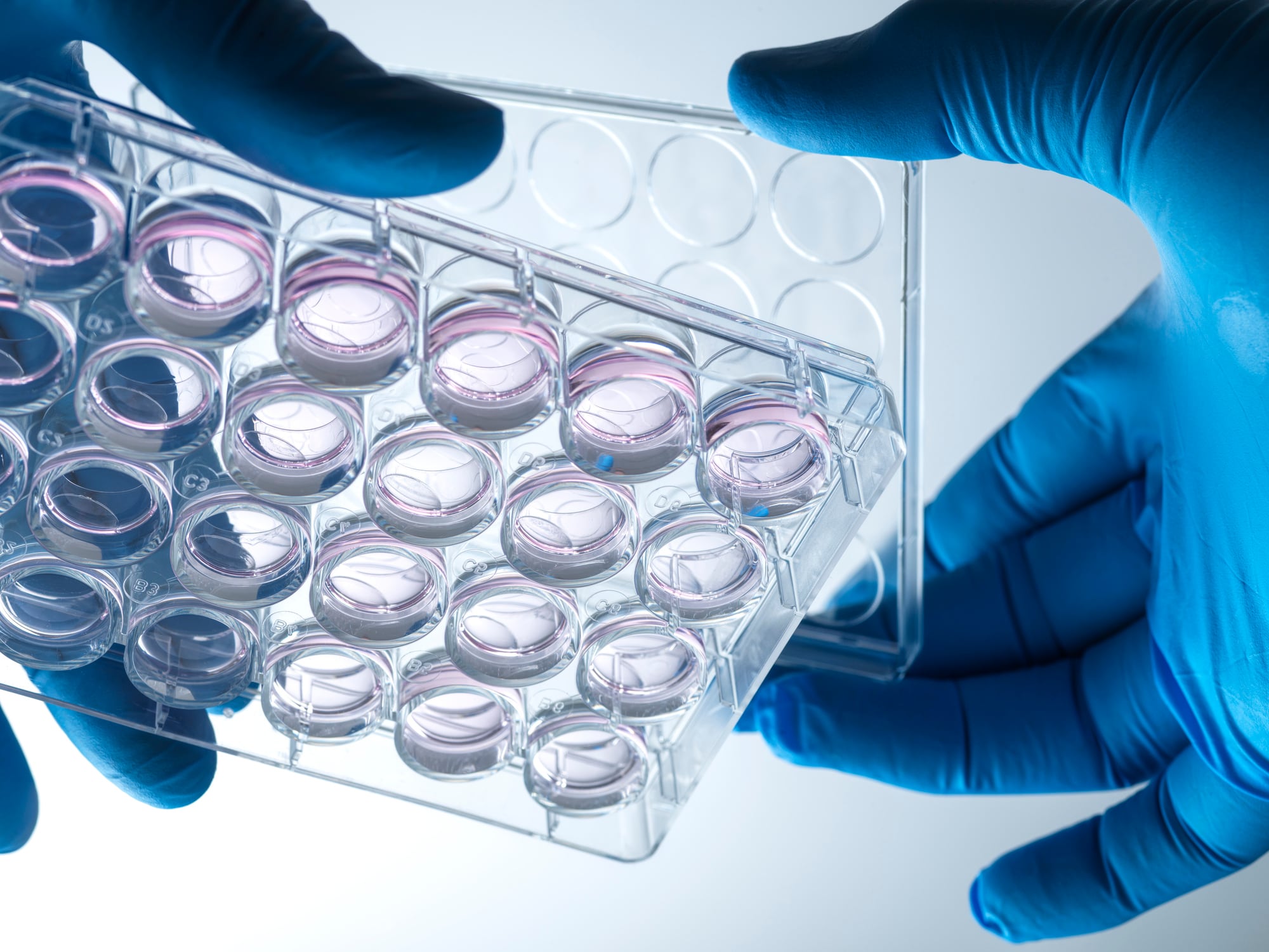 Agronomics is investing in SuperMeat and  cultivated chicken meat.