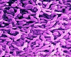 Campylobacter bacteria are the most common cause of food poisoning in the UK