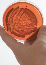 Cutbacks put public health at risk of E.coli, warn experts