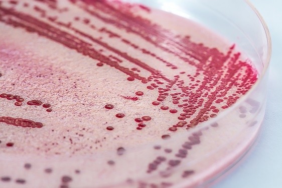 The Europe-wide listeria outbreak has so far killed nine people and affected a further 38