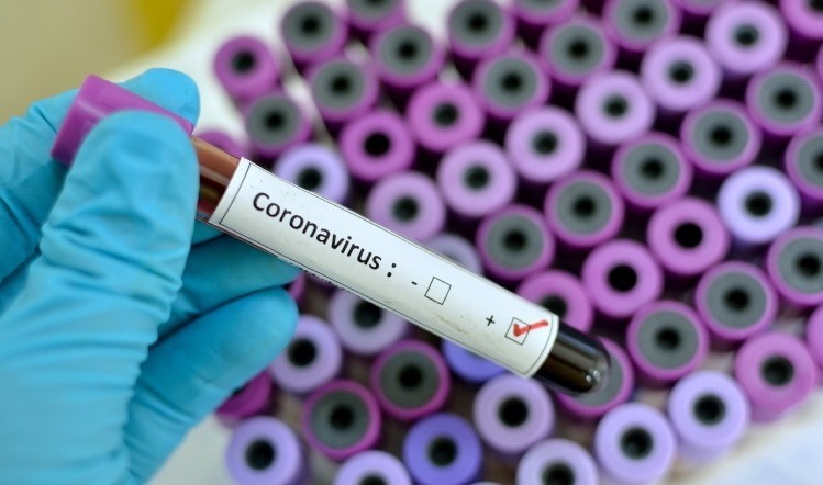 Fears are growing over the impact of the COVID-19 coronavirus 