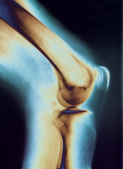 Daily Peptan reduced knee joint pain 